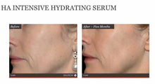 Load image into Gallery viewer, Focus Care Moisture+ HA Intensive Hydrating Serum
