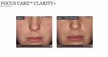 Load image into Gallery viewer, Focus Care Clarity+ Botanical Infused Sebu-Tone Clarifier
