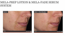 Load image into Gallery viewer, Focus Care Radiance+ Multi-Bioactive Mela-Prep Lotion (60ml)
