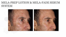 Load image into Gallery viewer, Focus Care Radiance+ Multi-Bioactive Mela-Prep Lotion (60ml)
