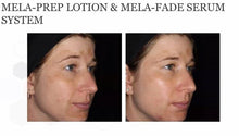 Load image into Gallery viewer, Focus Care Radiance+ Multi-Bioactive Mela-Prep Lotion (60ml)
