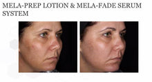 Load image into Gallery viewer, Focus Care Radiance+ Vita-Botanical Mela-Fade Serum System (2x30ml)
